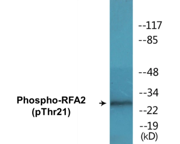 RFA2 (phospho Thr21) Cell Based ELISA Kit (A102672-296)