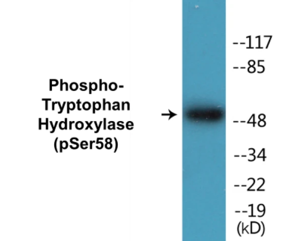 Tryptophan Hydroxylase (phospho Ser58) Cell Based ELISA Kit (A102367-296)