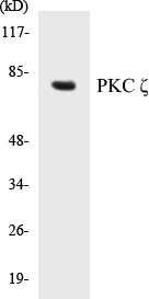 PKC zeta Cell Based ELISA Kit (A102963-96)