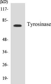 Tyrosinase Cell Based ELISA Kit (A103622-96)