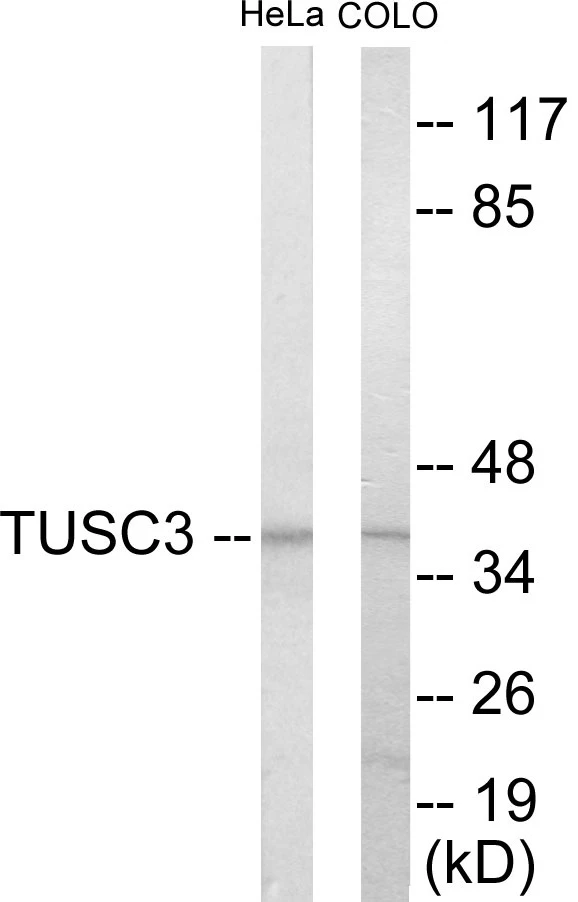 TUSC3 Cell Based ELISA Kit (A103161-96)