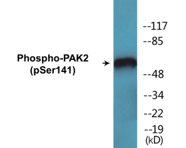 PAK2 (phospho Ser141) Cell Based ELISA Kit (A102250-296)