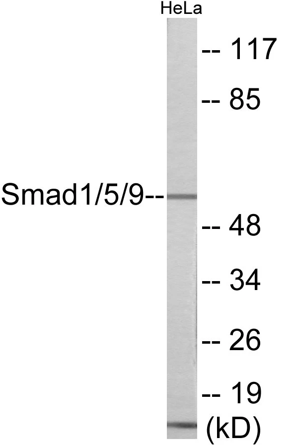 Smad1 + 5 + 9 Cell Based ELISA Kit (A102840-96)