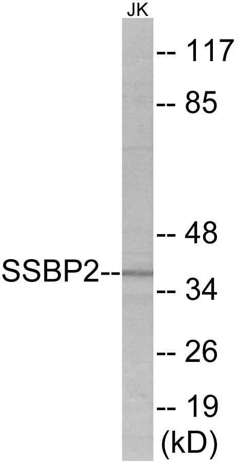 SSBP2 Cell Based ELISA Kit (A103472-96)