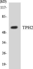 TPH2 Cell Based ELISA Kit (A103261-96)