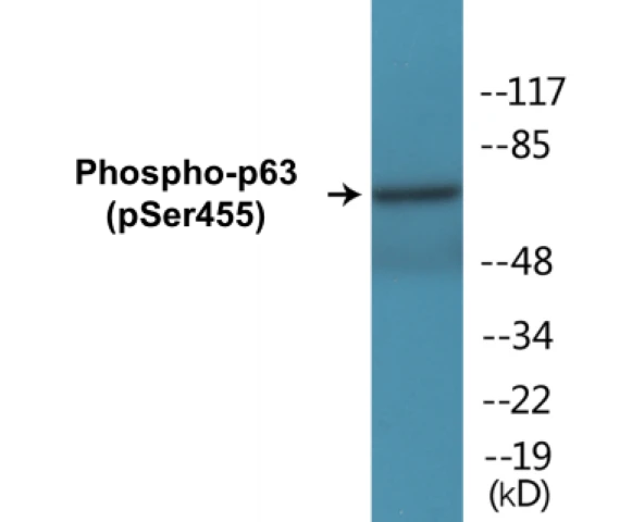 p63 (phospho Ser455) Cell Based ELISA Kit (A102756-296)