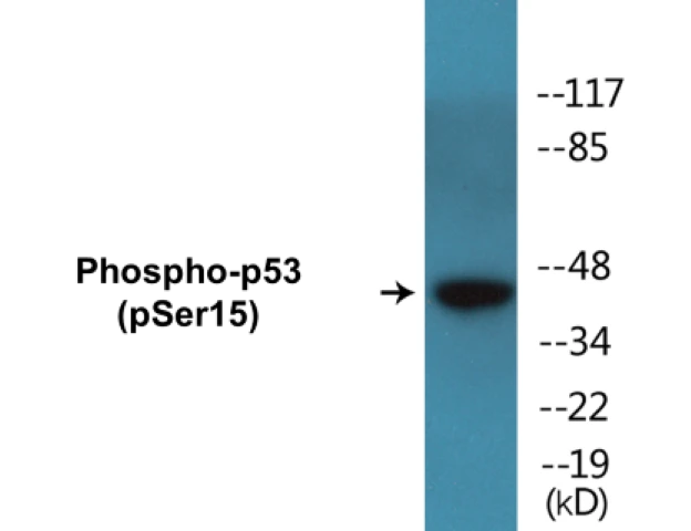 p53 (phospho Ser15) Cell Based ELISA Kit (A102699-296)