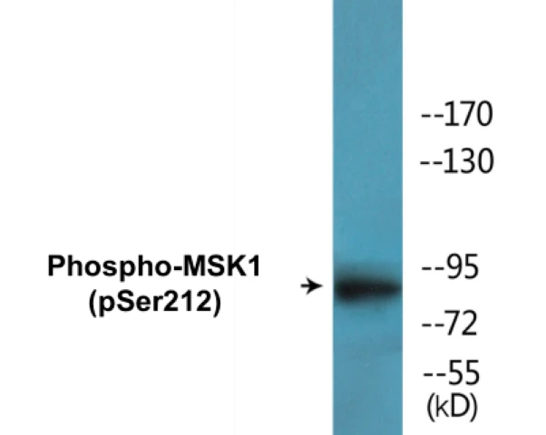 MSK1 (phospho Ser212) Cell Based ELISA Kit (A102641-296)