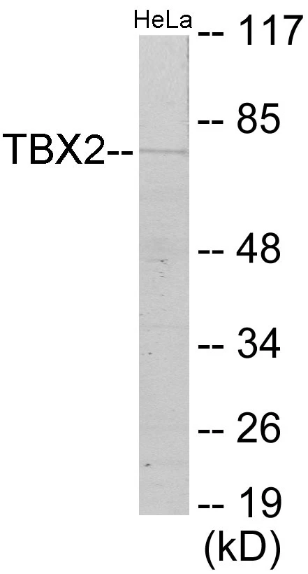 TBX2 Cell Based ELISA Kit (A103547-96)