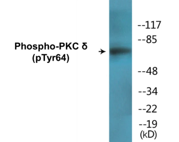 PKC&#0948; (phospho Tyr64) Cell Based ELISA Kit (A102450-296)