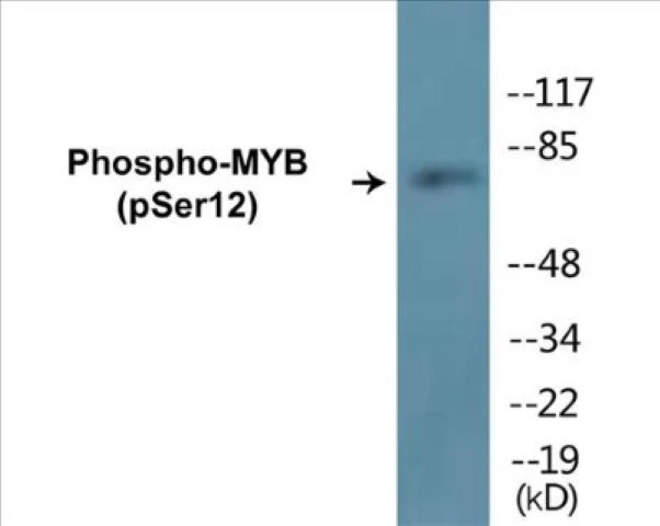 MYB (phospho Ser12) Cell Based ELISA Kit (A102677-296)