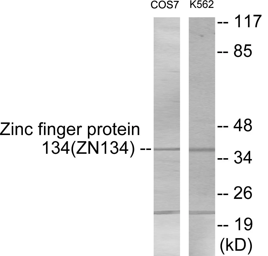 ZNF134 Cell Based ELISA Kit (A103655-96)