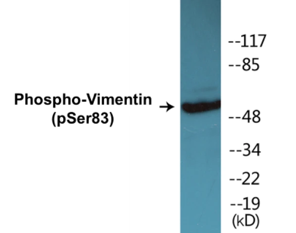 Vimentin (phospho Ser83) Cell Based ELISA Kit (A102058-296)