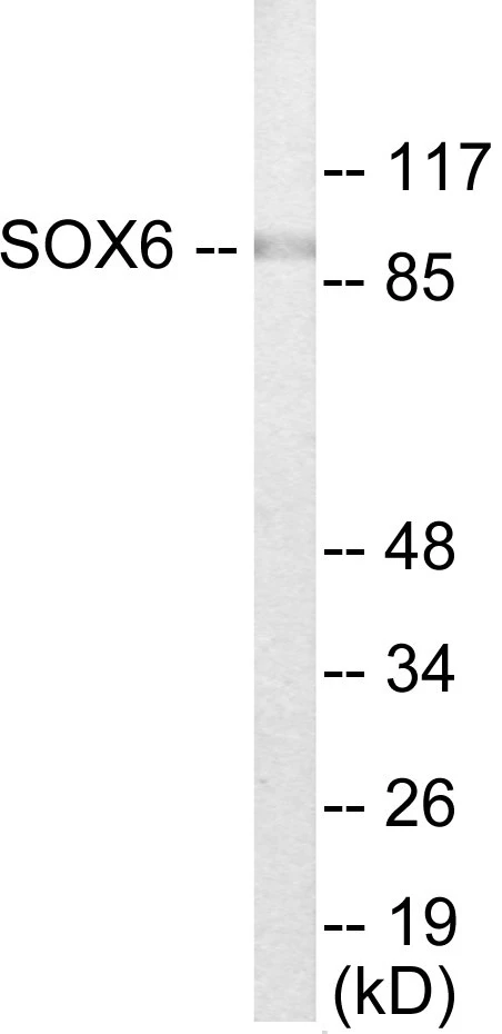 SOX6 Cell Based ELISA Kit (A103190-96)