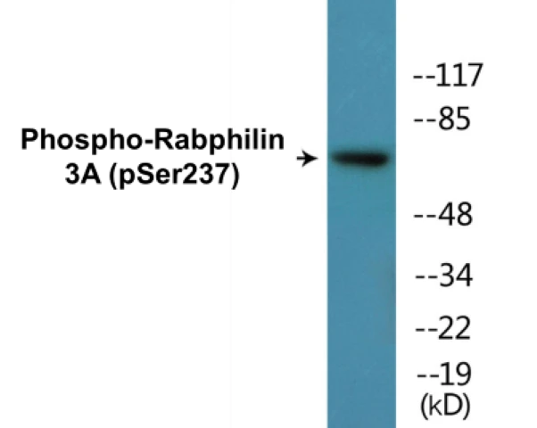 Rabphilin 3A (phospho Ser237) Cell Based ELISA Kit (A102490-296)