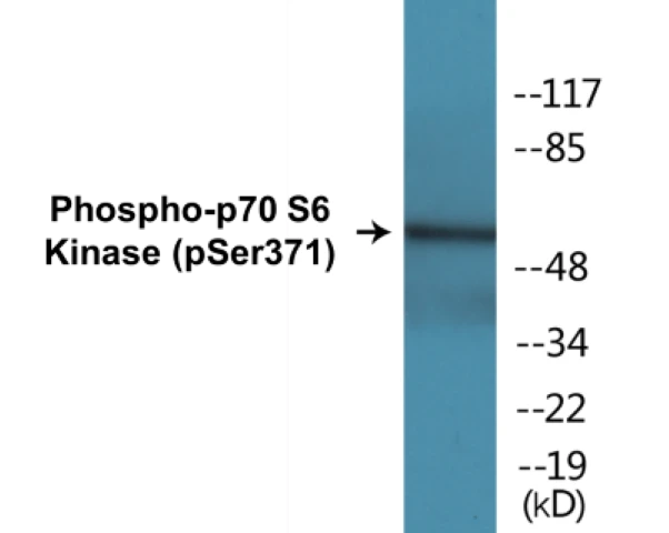 p70S6 Kinase (phospho Ser371) Cell Based ELISA Kit (A102488-296)