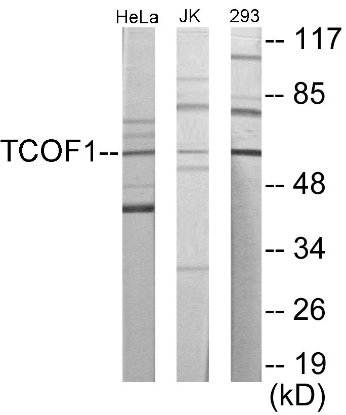 TCOF1 Cell Based ELISA Kit (A103476-96)