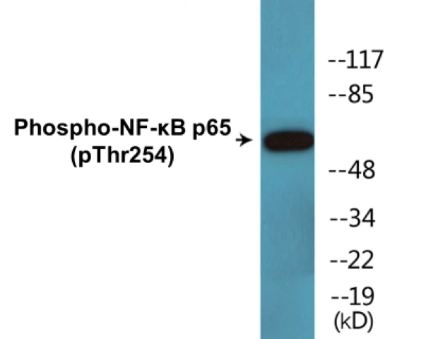 NF-kB p65 (phospho Thr254) Cell Based ELISA Kit (A102557-296)