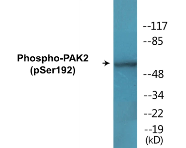 PAK2 (phospho Ser192) Cell Based ELISA Kit (A102351-296)