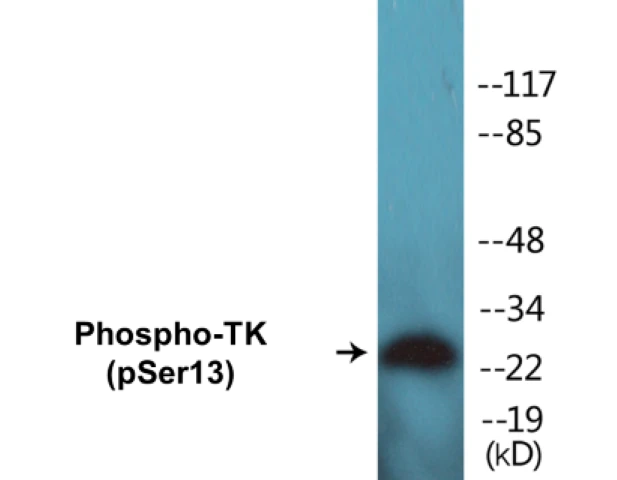 TK (phospho Ser13) Cell Based ELISA Kit (A102497-296)