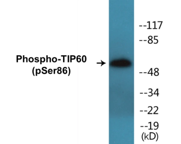 TIP60 (phospho Ser86) Cell Based ELISA Kit (A102650-296)