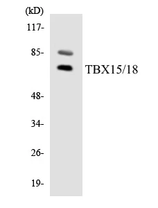 TBX15 + 18 Cell Based ELISA Kit (A103380-96)