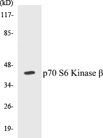 p70S6 Kinase beta Cell Based ELISA Kit (A103363-96)