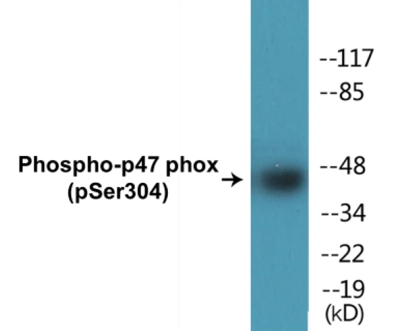 p47 phox (phospho Ser304) Cell Based ELISA Kit (A102783-296)