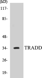 TRADD Cell Based ELISA Kit (A103424-96)