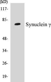 SENP2 Cell Based ELISA Kit (A103113-96)