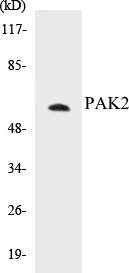 PAK2 Cell Based ELISA Kit (A103253-96)