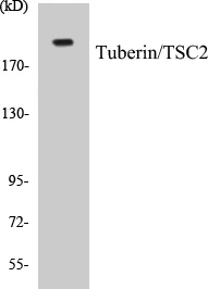 VASP Cell Based ELISA Kit (A103189-96)