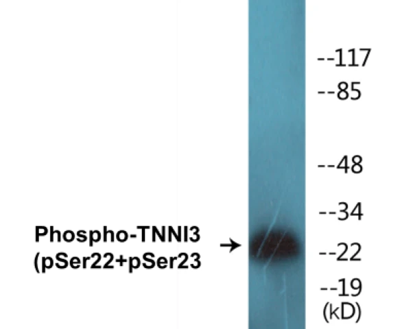 TNNI3 (phospho Ser22 + Ser23) Cell Based ELISA Kit (A102789-296)