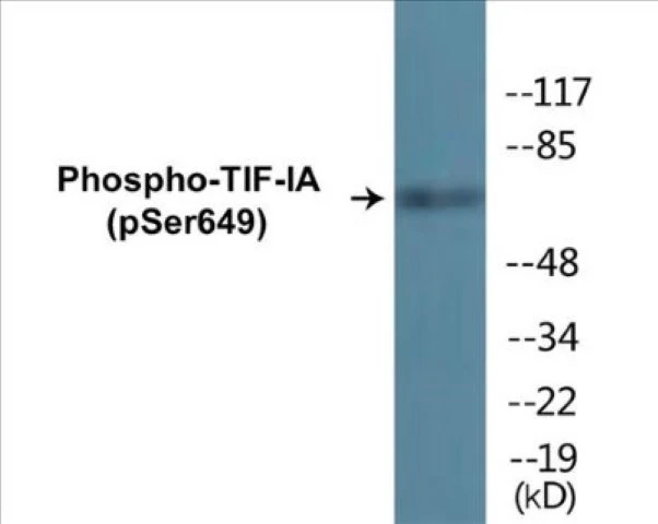 TIF-IA (phospho Ser649) Cell Based ELISA Kit (A102714-296)