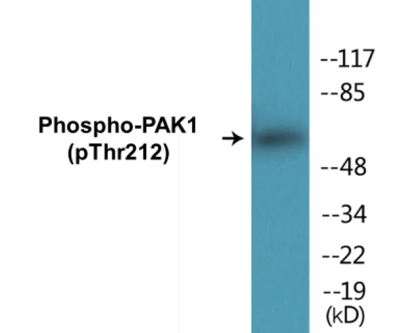 PAK1 (phospho Thr212) Cell Based ELISA Kit (A102275-296)