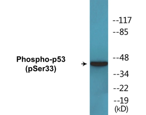 p53 (phospho Ser33) Cell Based ELISA Kit (A102762-296)