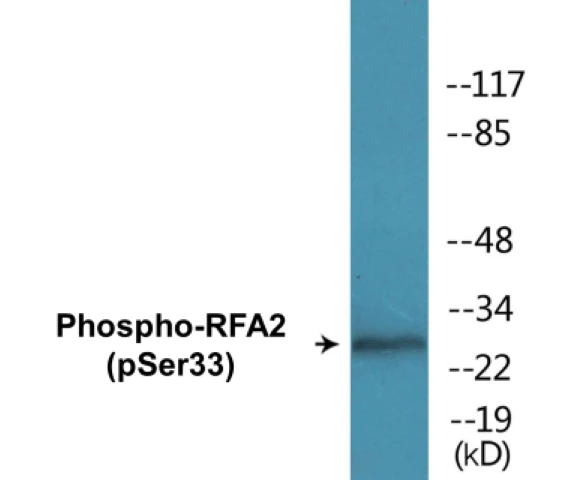 RFA2 (phospho Ser33) Cell Based ELISA Kit (A102453-296)