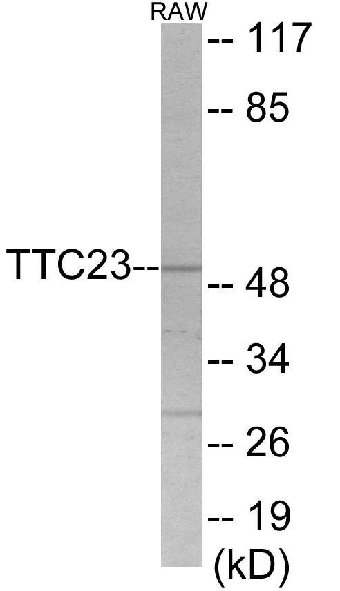 TTC23 Cell Based ELISA Kit (A103702-96)