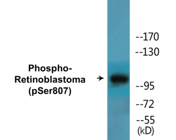 Retinoblastoma (phospho Ser807) Cell Based ELISA Kit (A102373-296)