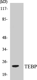 TEBP Cell Based ELISA Kit (A103258-96)