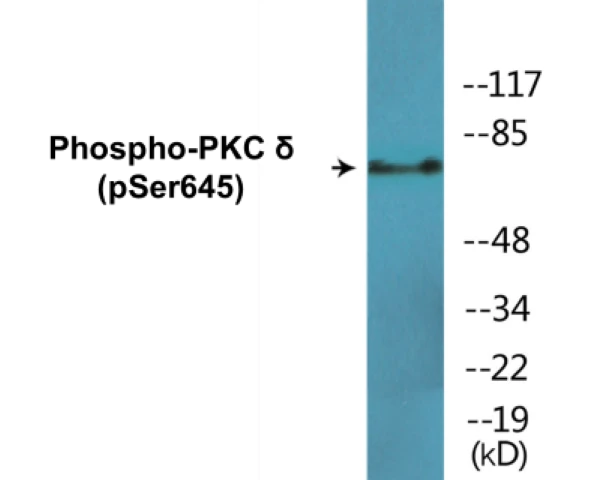 PKC delta (phospho Ser645) Cell Based ELISA Kit (A102779-296)