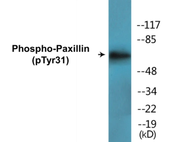 Paxillin (phospho Tyr31) Cell Based ELISA Kit (A102061-296)