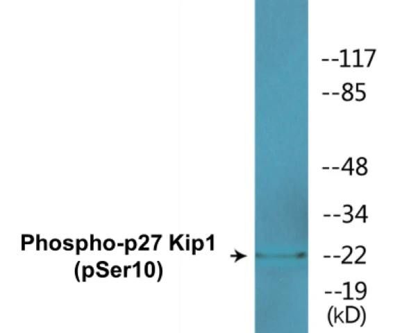 p27 Kip 1 (phospho Ser10) Cell Based ELISA Kit (A102569-296)