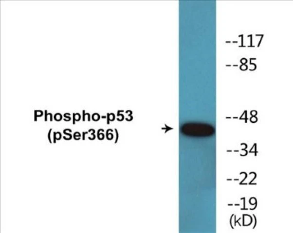 p53 (phospho Ser366) Cell Based ELISA Kit (A102759-296)