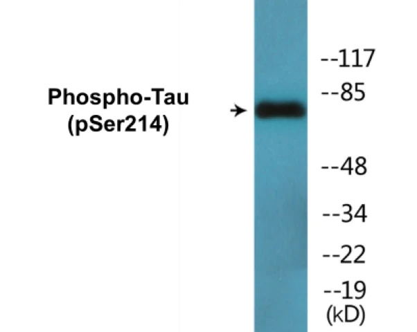 Tau (phospho Ser214) Cell Based ELISA Kit (A102386-296)