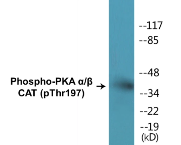 PKA alpha + beta (catalytic subunits) (phospho Thr197) Cell Based ELISA Kit (A102523-296)