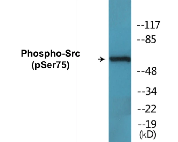 Src (phospho Ser75) Cell Based ELISA Kit (A102477-296)