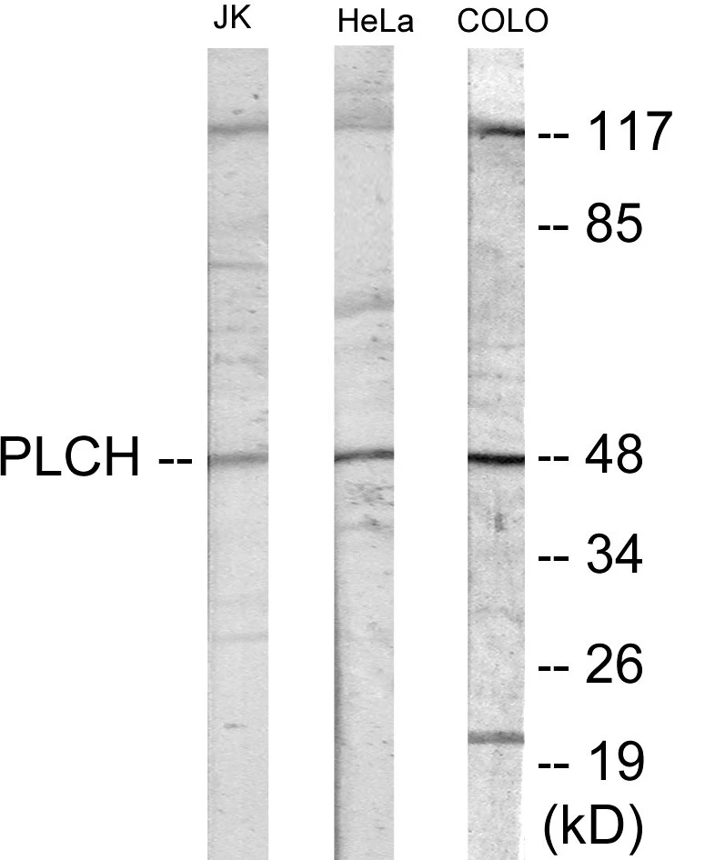 PLCH Cell Based ELISA Kit (A103299-96)