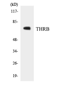 THRB Cell Based ELISA Kit (A103272-96)