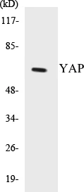 YAP Cell Based ELISA Kit (A103318-96)